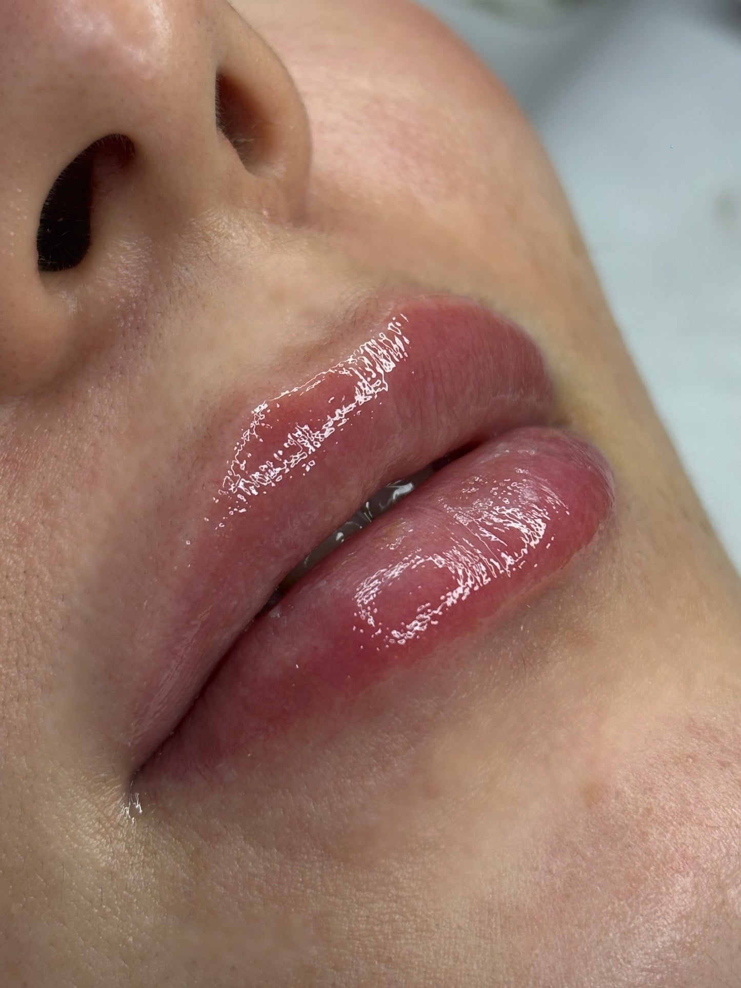 MASTERCLASS MESOLIPS lezione registrata