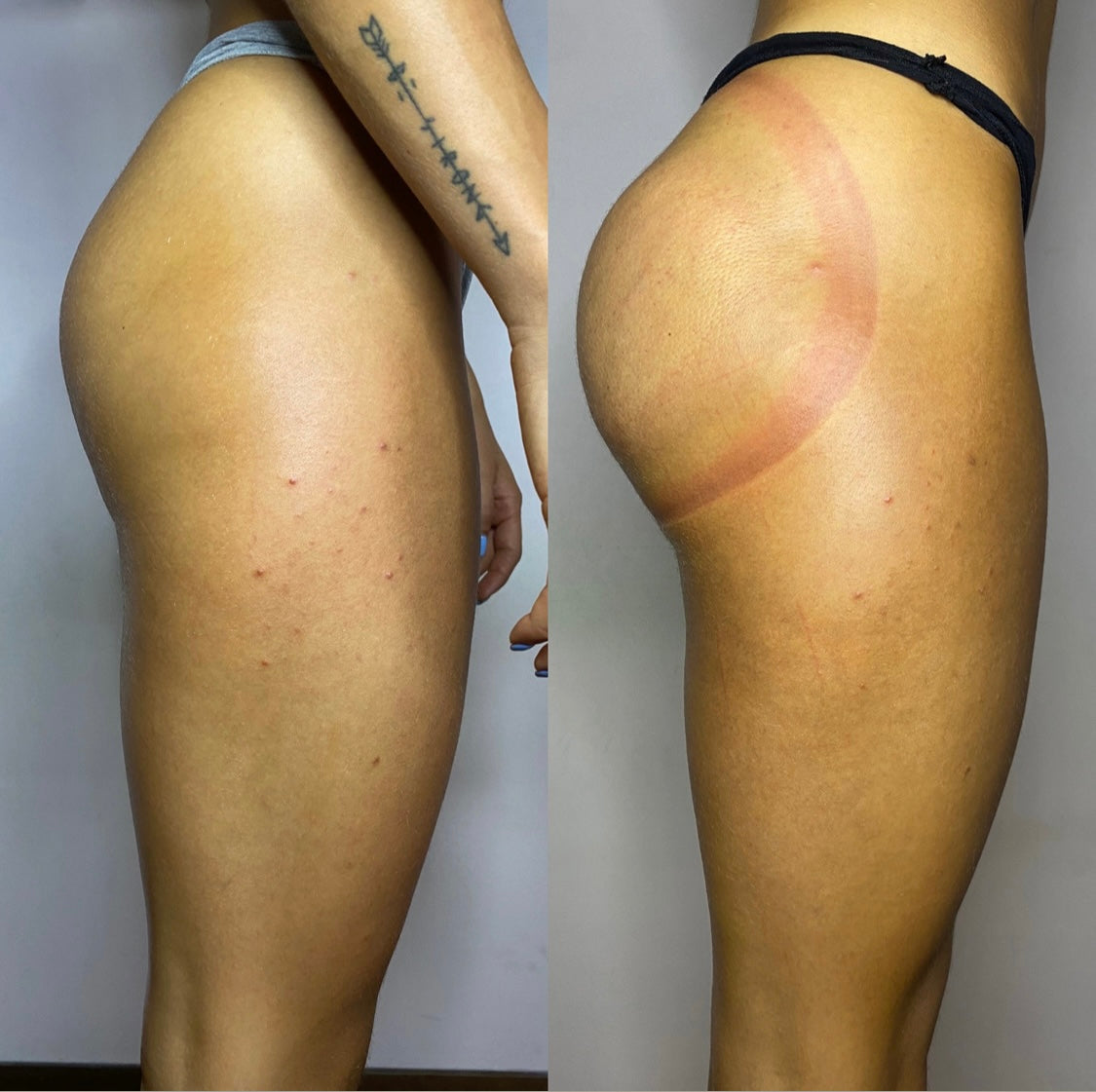 CORSO PUSH UP GLUTEI ONLINE INDIVIDUALE KIT INCLUSO