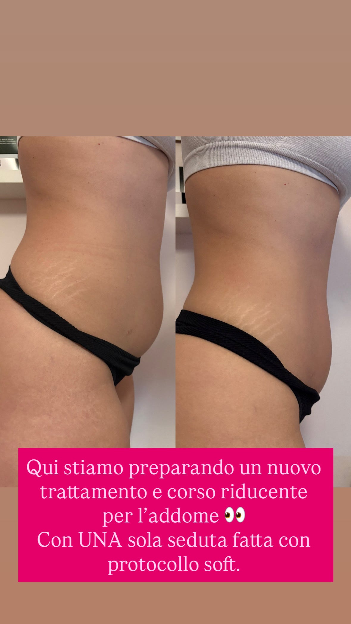 CORSO BODY SHAPE