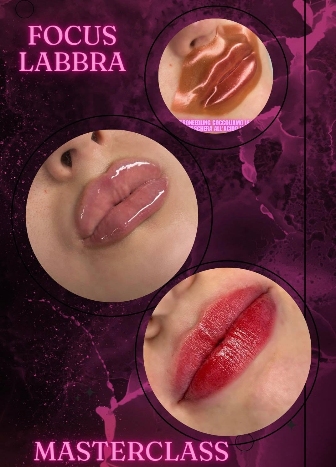 MASTERCLASS CANDYLIPS + MESOLIPS