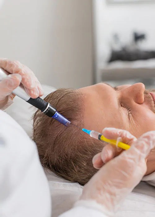 Masterclass MesoNeedling Cuoio Capelluto