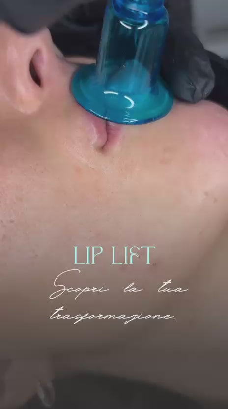 LIP LIFT